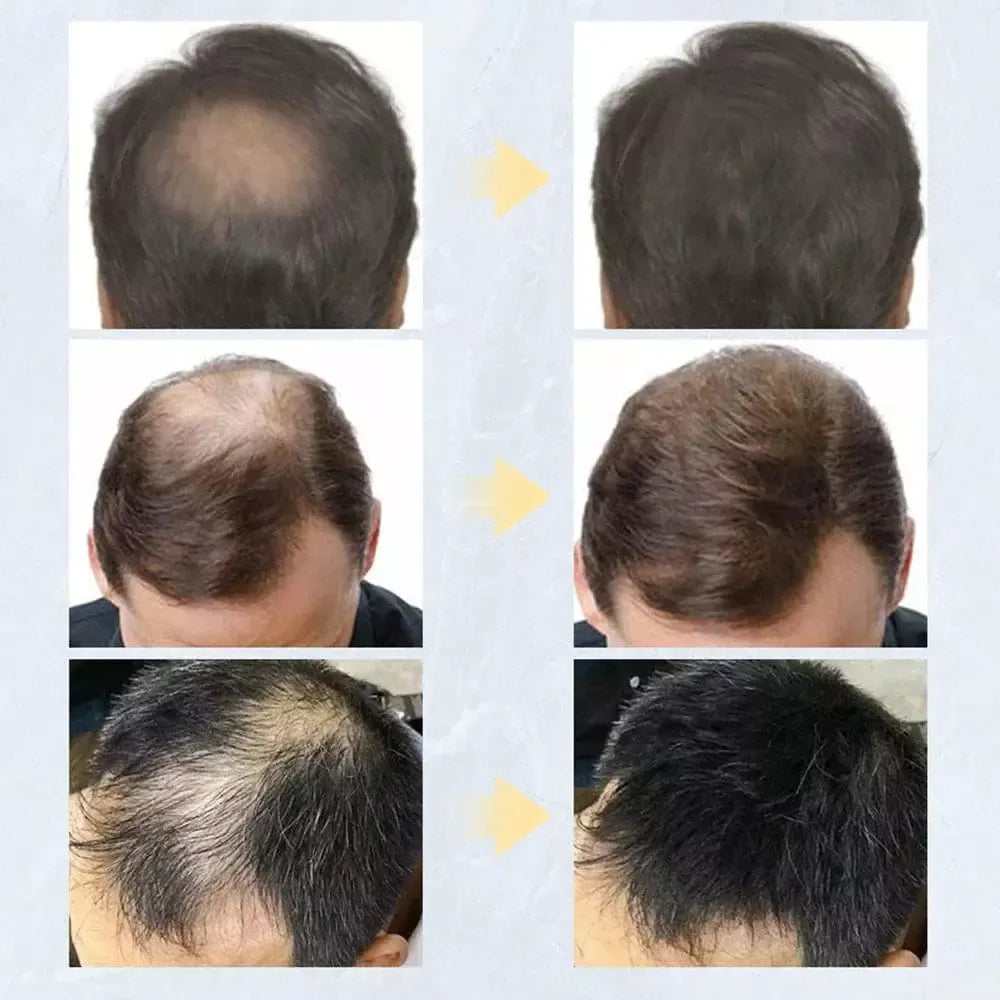 Toppik 
Toppik Hair 
Toppik Hair Fiber 
Fibra Capilar